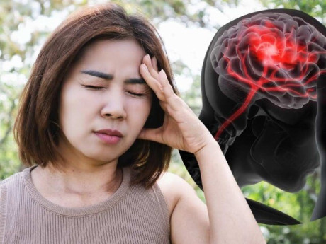 Chóng mặt tưởng bị rối loạn tiền đình, sau 3 ngày người phụ nữ bất ngờ khi biết bị nhồi máu não