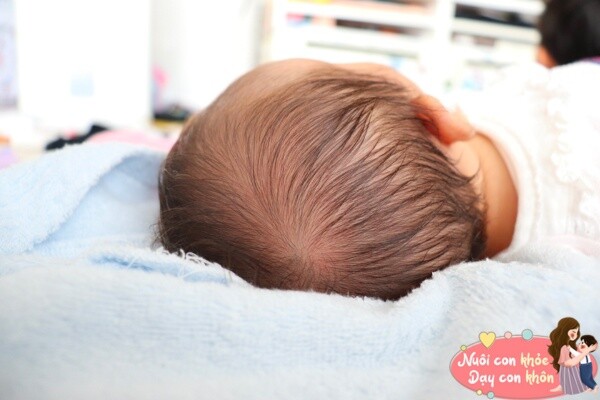 Trẻ nằm trên giường quá nhiều, hình dạng đầu có thể thay đổi vì bị chèn ép.