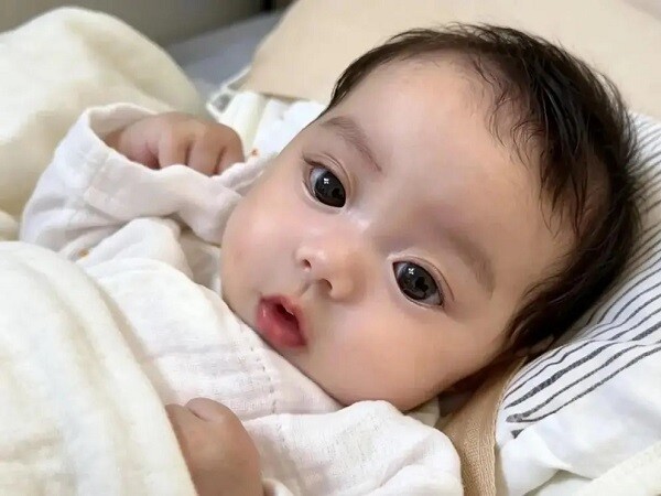 Em bé mới chào đời 4 bộ phận cơ thể này xấu xí, nhưng amp;#34;lớn lên sẽ trổ nétamp;#34; xinh đẹp - 7