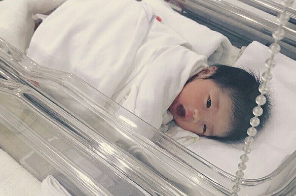Em bé mới chào đời 4 bộ phận cơ thể này xấu xí, nhưng amp;#34;lớn lên sẽ trổ nétamp;#34; xinh đẹp - 3