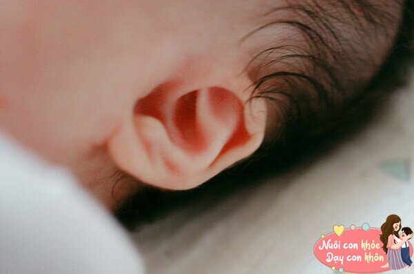 Trẻ em tai to và dái tai dày thường có khả năng nghe tốt.