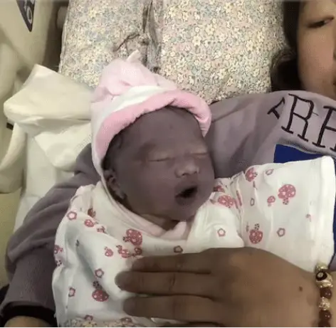 Con vừa chào đời đã có làn da tím khác thường, bố mẹ lo lắng, nào ngờ 2 tháng sau nhận không ra con - 1