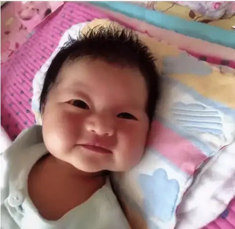 Nào ngờ vài tháng sau, đứa trẻ lột xác với đôi má phúng phính cực đáng yêu.