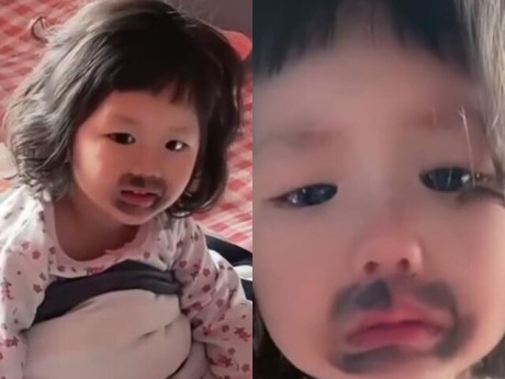 Ngủ dậy thấy miệng mọc vết bầm đen, bé gái khóc thét, mẹ phát hiện nguyên nhân từ món con ăn mỗi ngày