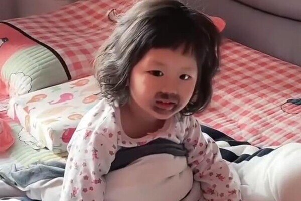 Ngủ dậy thấy miệng mọc vết bầm đen, bé gái khóc thét, mẹ phát hiện nguyên nhân từ món con ăn mỗi ngày - 1