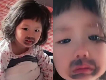 Ngủ dậy thấy miệng mọc vết bầm đen, bé gái khóc thét, mẹ phát hiện nguyên nhân từ món con ăn mỗi ngày