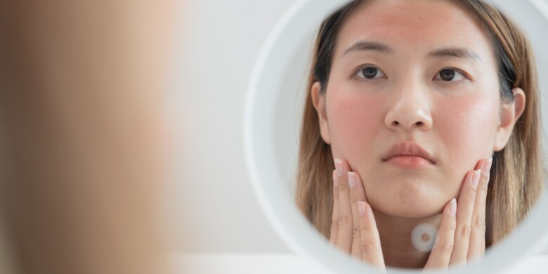 Khi tiết trời chuyển dần sang Thu, làn da chị em dễ gặp tình trạng khô ráp.