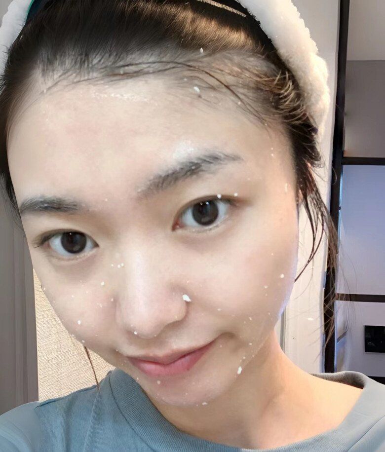 Tẩy da chết quá thường xuyên có thể làm tỏn thương lớp biểu bì da và gây mất collagen.