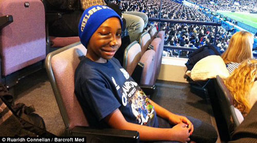 Khối u 2 kg trên mặt biến bé gái thành #039;Ngưu Ma Vương#039; - 2