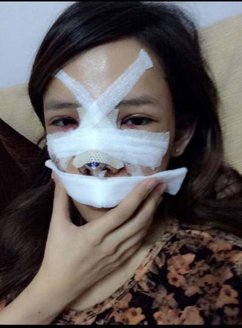 9x Việt chi nửa tỉ phẫu thuật thành hot girl vì bị chê xấu - 7