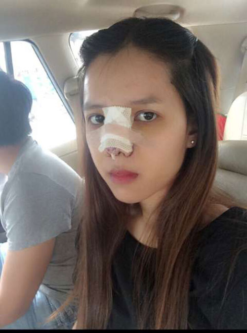 9x Việt chi nửa tỉ phẫu thuật thành hot girl vì bị chê xấu - 6