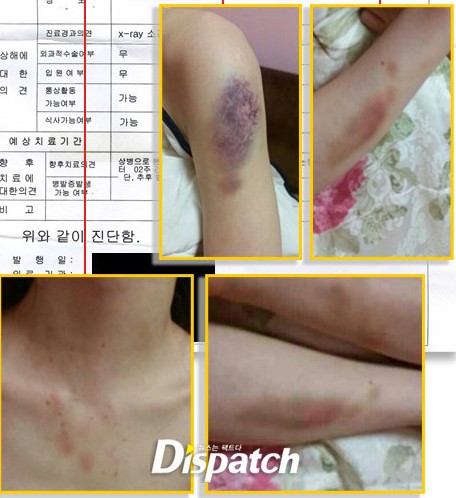 Những scandal chấn động nhất showbiz Hàn 2014 - 2