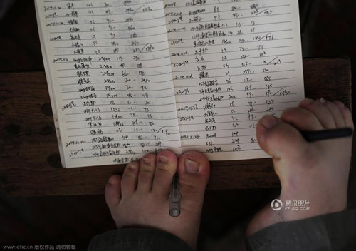 Chàng trai không tay thất học và ước mơ kinh doanh - 1