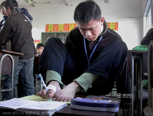 Chàng trai không tay thất học và ước mơ kinh doanh - 4