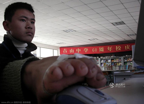 Chàng trai không tay thất học và ước mơ kinh doanh - 6