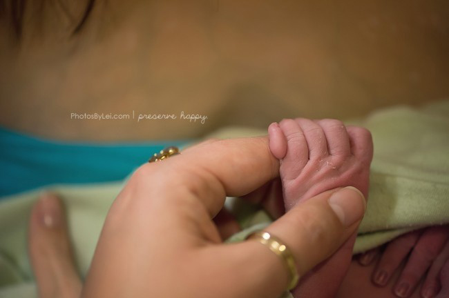 Hình ảnh một em bé sinh ra với 6 ngón tay được ghi lại bởi nhiếp ảnh gia Leilani Rogers.
