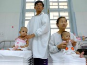 Tin tức - Cuộc sống mới của hai bé gái song sinh dính liền mông, không có hậu môn sau hơn 1 năm