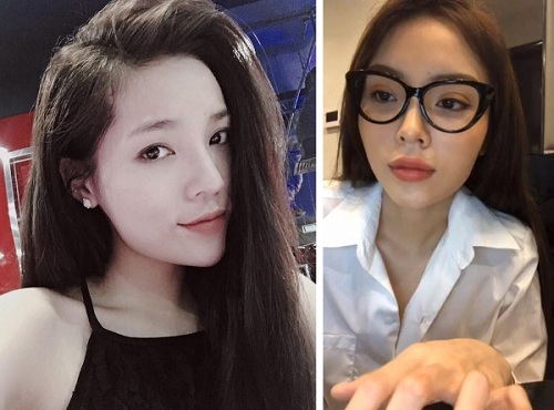 Kỳ Duyên tiếp tục dính nghi vấn phẫu thuật mí với hình ảnh đôi mắt khác lạ - 5