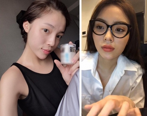 Kỳ Duyên tiếp tục dính nghi vấn phẫu thuật mí với hình ảnh đôi mắt khác lạ - 7