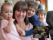 Bà bầu - Kỳ bí chuyện mang thai, sinh nở của những người phụ nữ có hai âm đạo