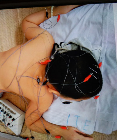 Bé trai 8 tuổi ở Hà Nội mắc bệnh lạ: Cứ ngóc đầu lên là ngất xỉu - 4