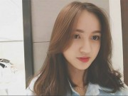 Làm đẹp - Phẫu thuật căng da mặt cũng có rất nhiều rủi ro và biến chứng chứ không hề dễ