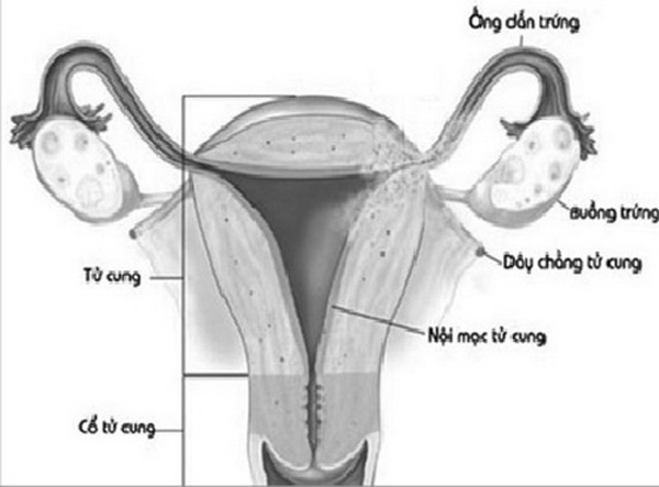 nguyen nhan va cach chua tri vo kinh chi em can biet - 1