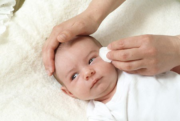 Cách chăm sóc khi trẻ sơ sinh bị đau mắt đỏ, giúp bé nhanh khỏi - 2