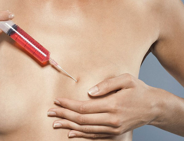 Bạn chọn nâng ngực bằng chất làm đầy, mỡ tự thân hay túi độn? - 3