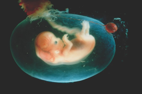 Những bí mật mẹ chưa biết về túi ối - amp;#34;ngôi nhàamp;#34; của con suốt 9 tháng 10 ngày - 1