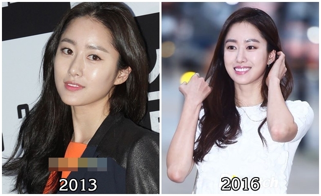 Cùng can thiệp dao kéo nhưng các người đẹp này kẻ lên hương - người xuống sắc! - 3