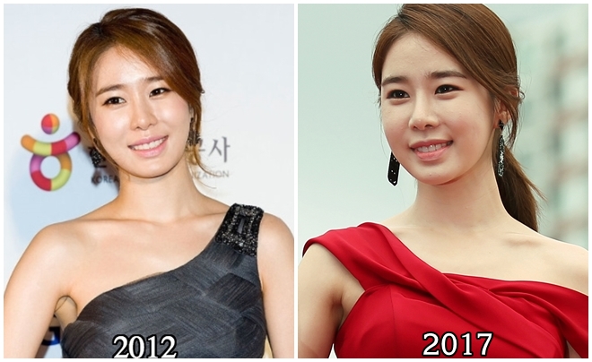 Cùng can thiệp dao kéo nhưng các người đẹp này kẻ lên hương - người xuống sắc! - 6