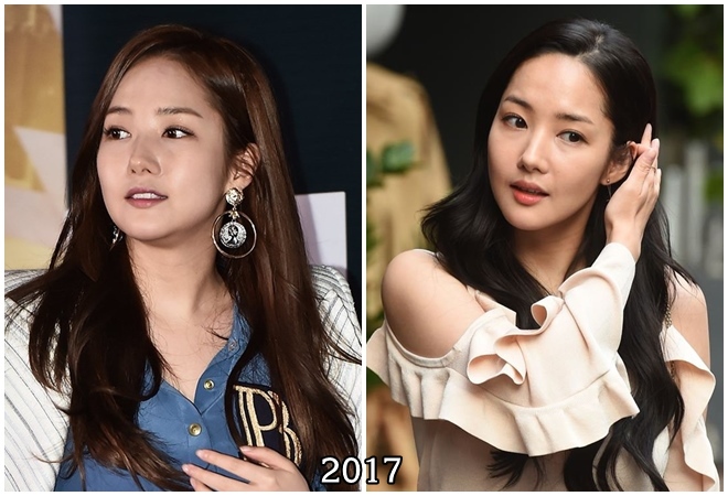 Cùng can thiệp dao kéo nhưng các người đẹp này kẻ lên hương - người xuống sắc! - 16