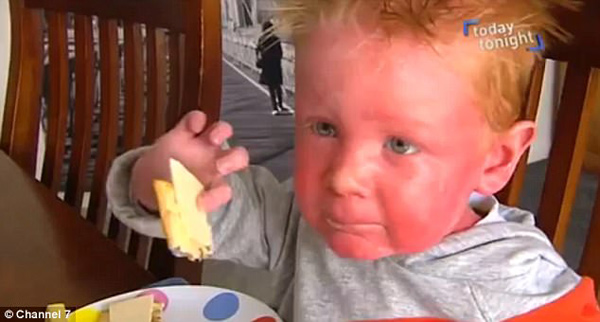 Bé trai có làn da đỏ ứng, đi đâu người lạ cũng nghĩ bị bố mẹ bạo hành - 1