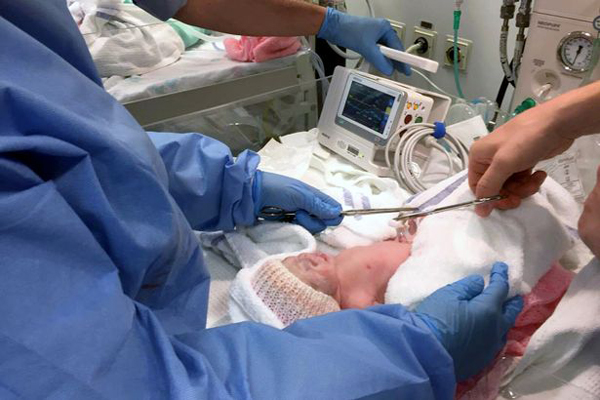 Kỳ diệu ca sinh mổ 3 thai với một bé nằm nguyên trong bọc ối - 5