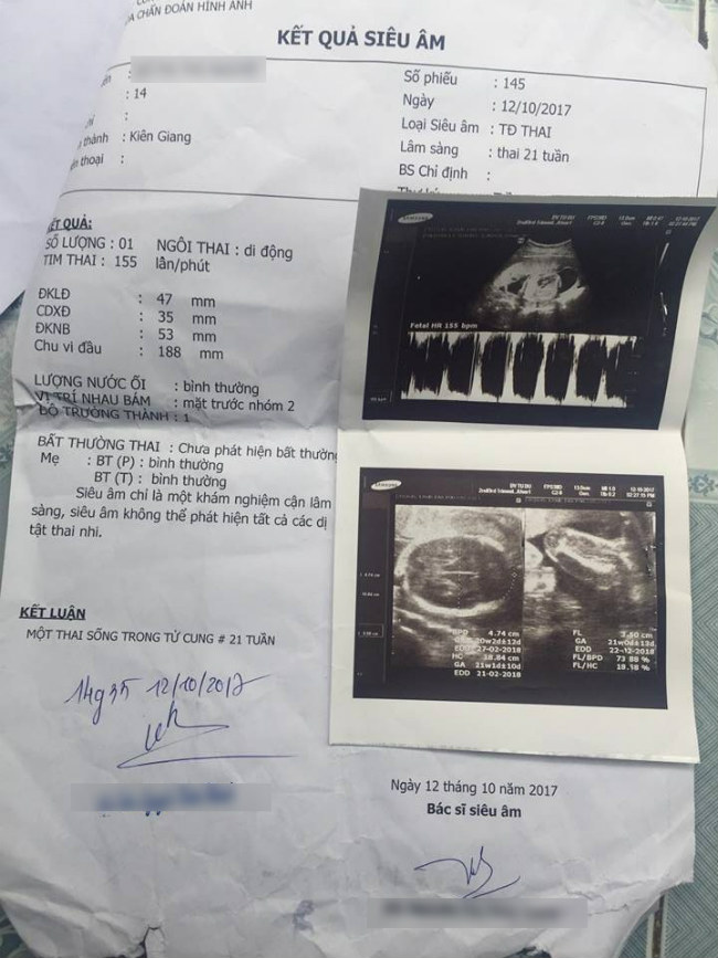 Bé gái 14 tuổi bị hàng xóm xâm hại đến mang thai, phải nghỉ học chờ sinh con - 3