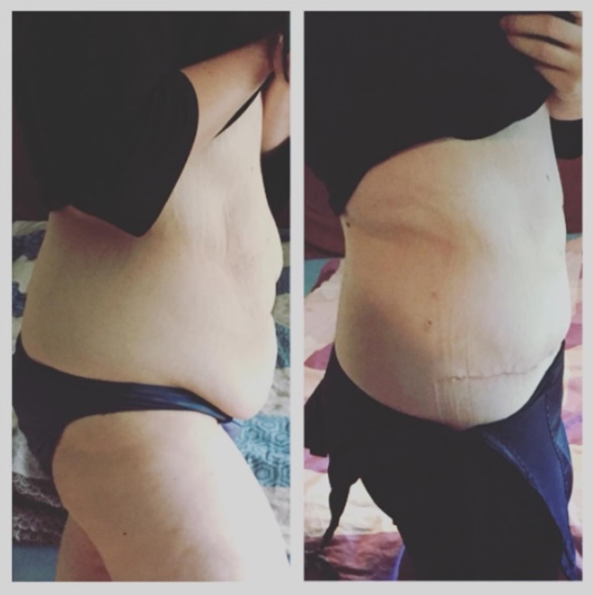 Từng nặng hơn 100kg, trong 2 năm cô gái người Đức quyết tâm giảm một nửa trọng lượng - 12