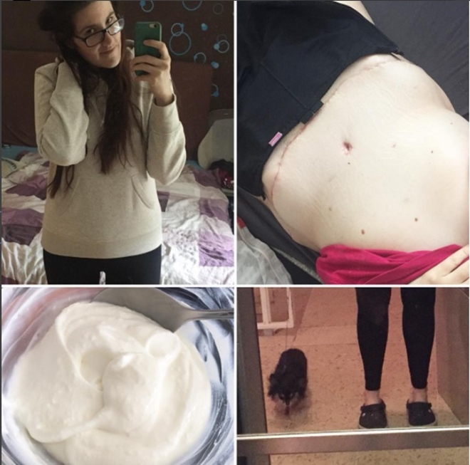 Từng nặng hơn 100kg, trong 2 năm cô gái người Đức quyết tâm giảm một nửa trọng lượng - 13