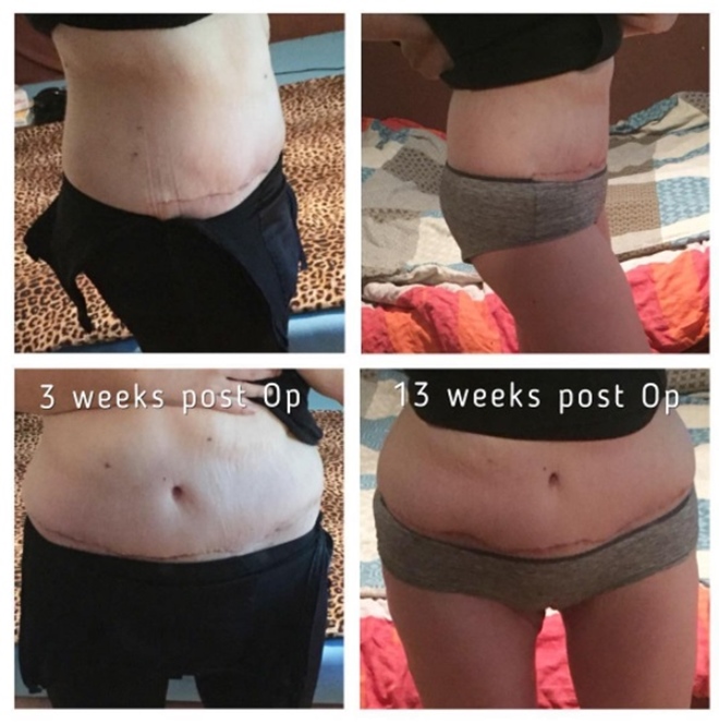 Từng nặng hơn 100kg, trong 2 năm cô gái người Đức quyết tâm giảm một nửa trọng lượng - 14