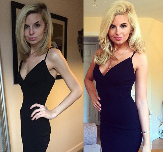 Màn biến hình ngoạn mục của những cô nàng cò hương trước và sau tăng cân - 1