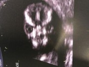 Tin tức - Người mẹ khoe bức ảnh siêu âm thai nhi kỳ lạ gây chấn động cộng đồng mạng