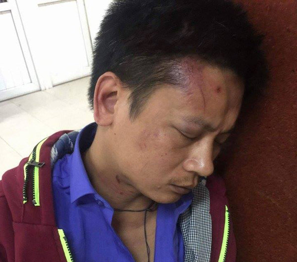 Đưa người nhà đến BV Phụ sản Hà Nội cấp cứu, người đàn ông bị 3 bảo vệ hành hung - 1