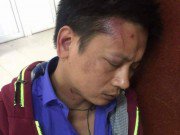 Tin tức - Đưa người nhà đến BV Phụ sản Hà Nội cấp cứu, người đàn ông bị 3 bảo vệ hành hung