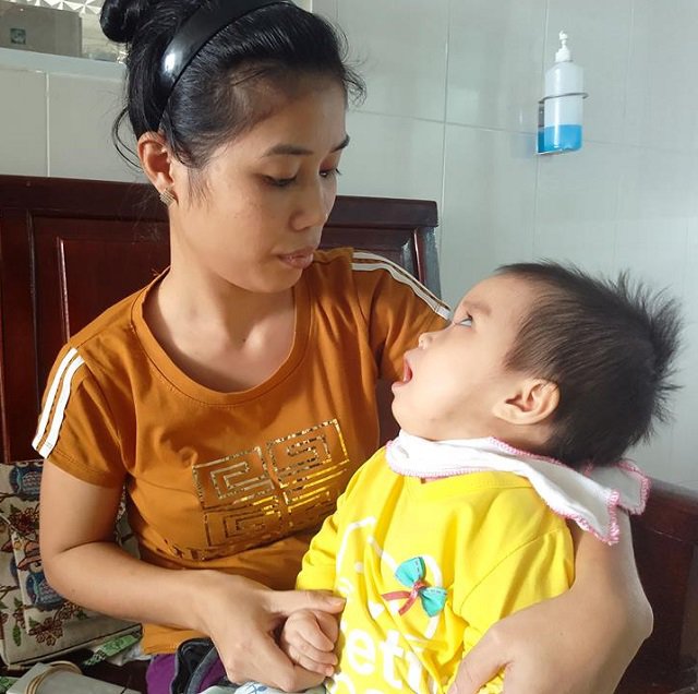 Bé gái 13 tháng tuổi bị teo não, nhiễm trùng máu vì bị côn trùng đốt vào tai - 2