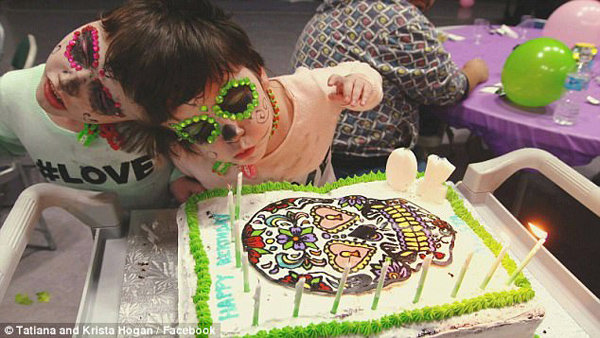 Cuộc sống của cặp song sinh liền đầu biết mọi suy nghĩ của nhau nhưng tính cách trái ngược - 6