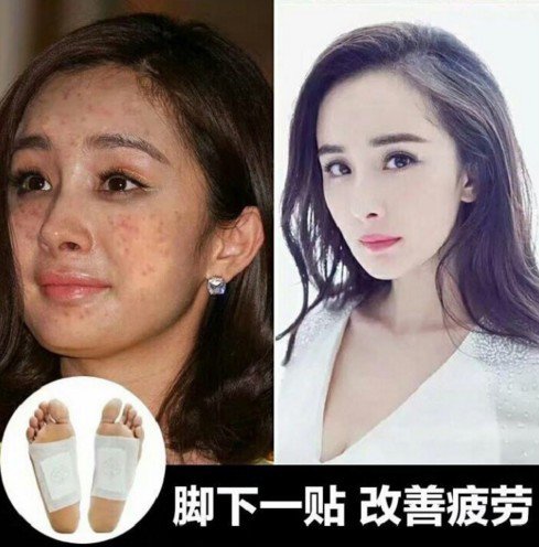 Ngôi sao 24/7: Sự thật đằng sau gương mặt chi chít mụn đến phát sợ của Dương Mịch - 1