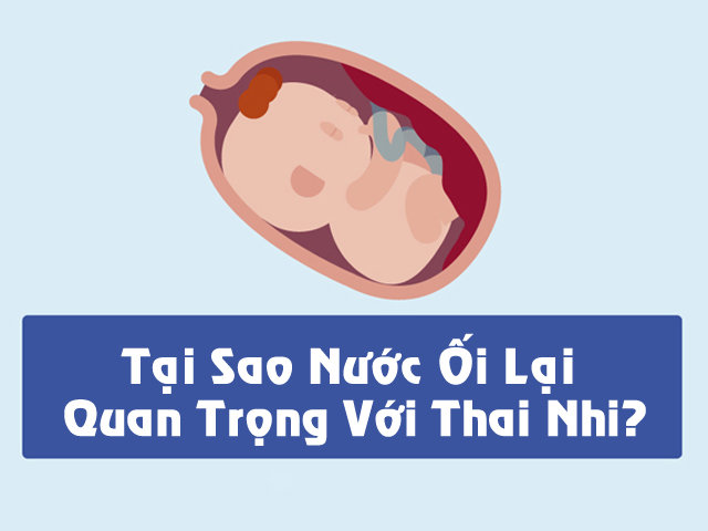 3 việc mẹ bầu nhớ phải làm để tốt nhất cho nguồn nước ối