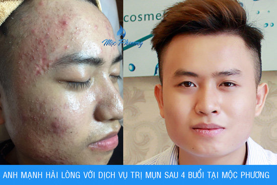 Thẩm mỹ Mộc Phương tung khuyến mãi “khủng” mừng ngày Nhà giáo Việt Nam - 3
