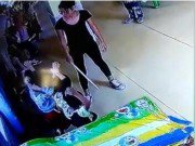 Tin tức - Con trai 5 tuổi bị thâm ở má, mẹ hoảng hồn phát hiện con bị cô giáo đánh mỗi ngày
