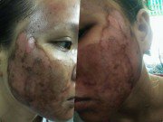 Làm đẹp - Đến khi nào các nàng mới thôi rước họa vào thân vì những phương pháp làm đẹp này?